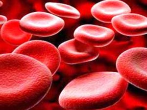 ipoferritinemia